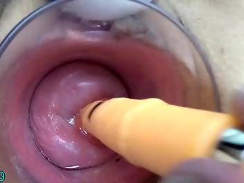 JAV MILF s Alluring Cervix Fucked by German Real Penis and Chopsticks